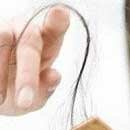  Лечение выпадения волос 